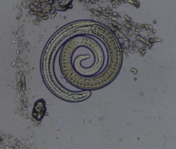 trihinella